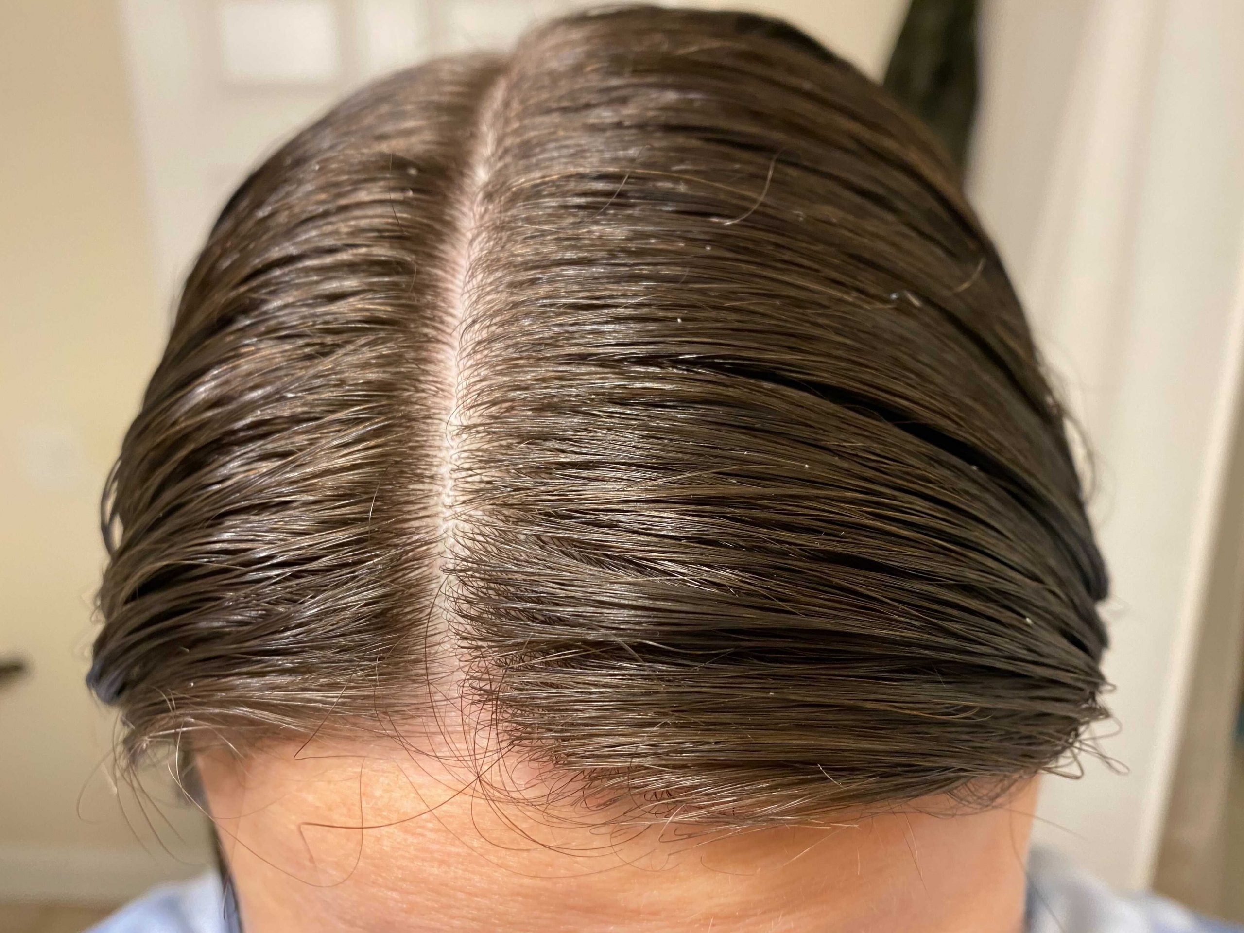 image of clean scalp and hair